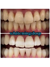 ホワイトニングショップ 武蔵小杉店/武蔵小杉ホワイトニング美白ケア