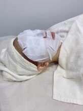 リンフェイス 浦安店(RINFACE)/ヒト乳歯幹細胞贅沢パック