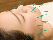 上毛鍼灸院/美容鍼