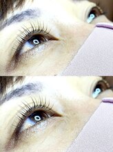 アンクラピス(AnkLapis)