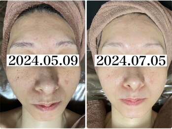 ホワイトアクア 四日市店(WHITE AQUA)/ララピール四日市三重