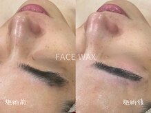 ミコサロン(miko salon)/フェイスワックス
