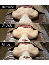 リノレア(LinoLea)/