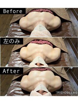 リノレア(LinoLea)/