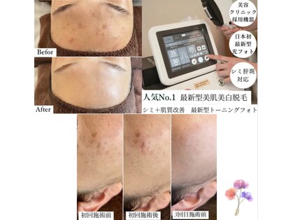 マーレ(Mare)の写真