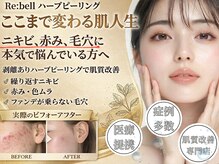 サラ
