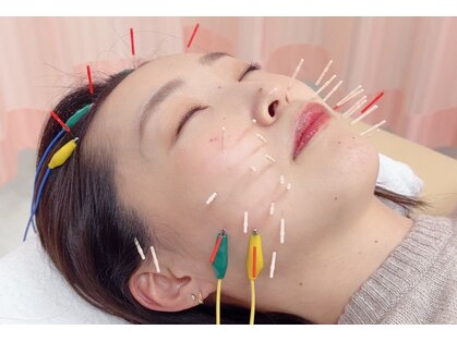 木下美容鍼灸整骨院の写真
