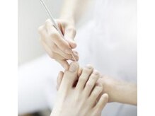 ネイルサロン ヴィヴィ(nail salon ViVi)/足の巻き爪、ご相談ください
