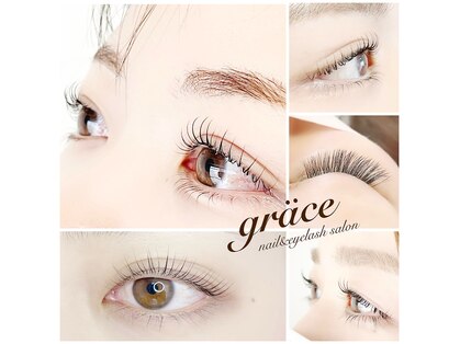 グレイス(grace)の写真