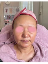 リフティングラボ(LIFTING LAB)/