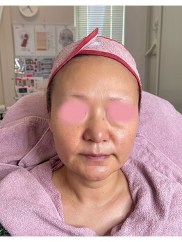 リフティングラボ(LIFTING LAB)/