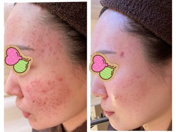 ビエル(Bielle)/原因不明のトラブルも