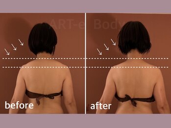 アルテ(ART-e)/Before/After 50代女性～2～