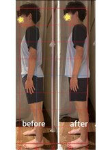 スイレン 西新宿(SUIREN)/姿勢改善