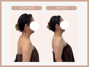 スリムライン 青森店(The Slim Line)/before→after