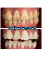 ホワイトニングショップ 武蔵小杉店/武蔵小杉ホワイトニング美白ケア