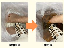 スズラン(SUZURAN)/ゴットクリーナー【30分後】