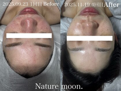 ナチュールムーン(Nature moon.)の写真