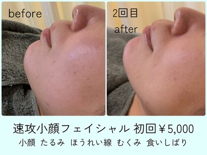 ほねつぎ一休さん 宇品店の写真