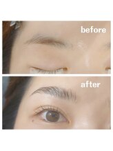 ゲート 吹田店(GATE)/ハリウッド美人コース