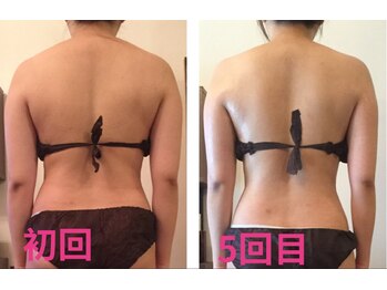 ココクレール(Coco Clair)/痩身 before →after