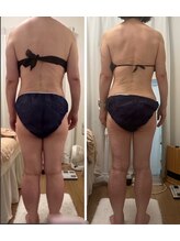 クールグラシュー(couer gracieux)/＃お背中ケアにも◎