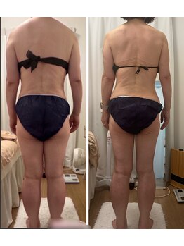 クールグラシュー(couer gracieux)/#お背中ケアにも◎