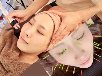 リリーフ(relief)の写真/毛穴＆顔周りを引き締め！リフトｕｐ潤艶実感◎美容鍼＋フェイシャルSET★自分だけの落ち着いた空間で♪