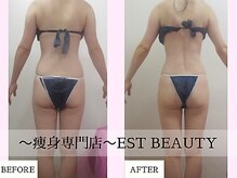 エストビューティー 池袋店(EST BEAUTY)/結果の出る技術【池袋/痩身】