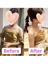 ボディキュア ブライダル美容整体 大阪梅田/【デコルテ美人】華奢な印象に