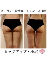 ケンビラク(Kenbiraku 健美楽)/ヒップアップ・小尻　ホームケア