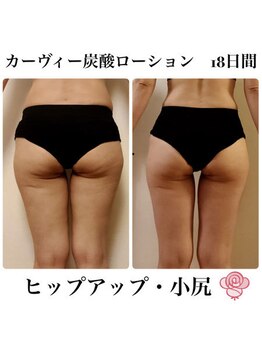 ケンビラク(Kenbiraku 健美楽)/ヒップアップ・小尻　ホームケア