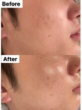 ベル(belle)/韓国式 &nbsp;艶玉肌★