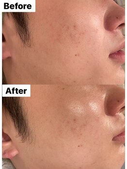 ベル(belle)/韓国式 艶玉肌★