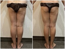 美容整体 ウェリナ 蟹江院/小顔矯正/骨盤矯正/美脚サロン