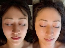 ルシエルリュクス(Le Ciel Luxe)の雰囲気（施術後のリフトアップ効果にお喜びの声多数♪[小顔矯正/広尾]）