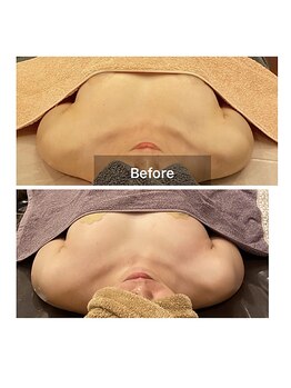 ベンザイ 新潟店(BENZAI)/2カップUP