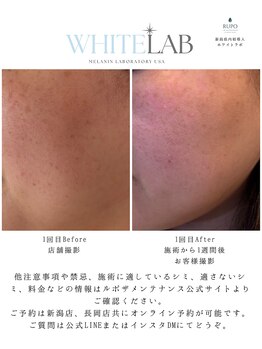 ルポザメンテナンス 長岡店(RUPO THE MAINTENANCE)/シミ除去ホワイトラボ県内初導入