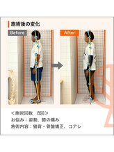 ただき接骨院 整体院 高崎本院/お悩み：姿勢、膝の痛み