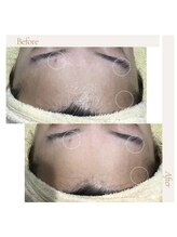 ファロンビューティー(fallon beauty)/お客様ビフォー×アフター