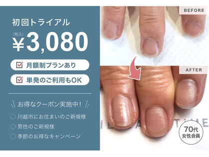 ネイルケアタイム メディカルセンター川越店(NAIL CARE TiME)の写真
