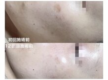 ロータス 千早香椎店(Lotus.)の雰囲気（長年のお悩みに本気のシミケア！【千早/香椎/シミ/しわ】）