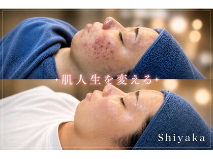 エステプロラボ 新潟の写真