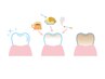 【VIP★回数券】トリプルホワイトニング◇10分×3回照射 6回券