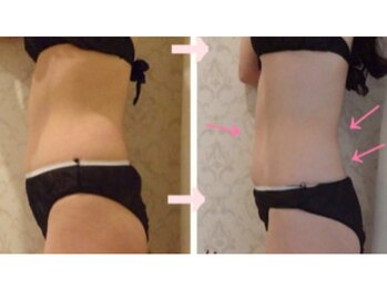 アンベリ(Embelli)/