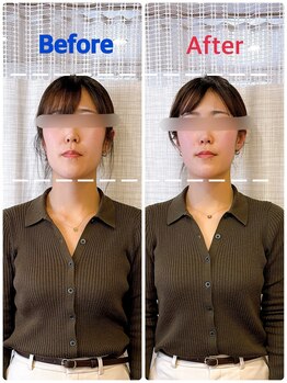 イズム まつもと店(izm)/小顔モニター様 2回目