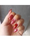 My nail