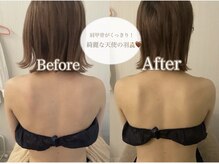 ミセル(MISEL2nd)/魅せる背中美人★