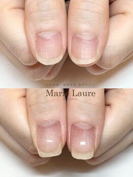 マリーロール 淀屋橋本店(Marie Laure)/深爪矯正/自爪育成/ネイルケア
