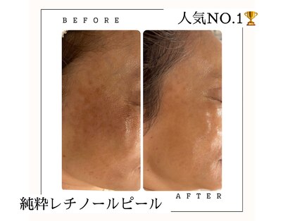 ナチュリフィール(naturefeel)の写真